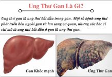 Ung thư gan,bệnh ung thư gan thật sự nguy hiểm thế nào? ung thu gan la gi-phongkhamchuyengan