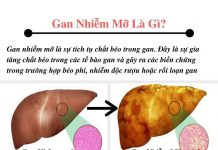 Bệnh gan nhiễm mỡ là gì,biểu hiện của bệnh Benh gan nhiem mo la gi bieu hien cua benh