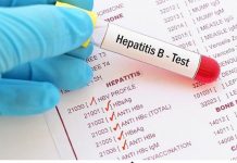 Các đánh giá trước điều trị viêm gan B Cac danh gia truoc dieu tri viem gan B